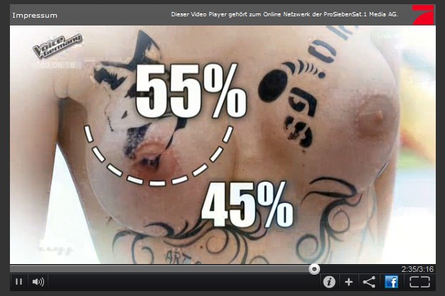 Der Silikonbusen von Melanie M�ller hat ein
                Verh�ltnis von 45 zu 55%